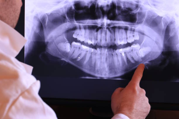 Best Emergency Treatment for Dental Infections or Abscesses in Laredo, TX